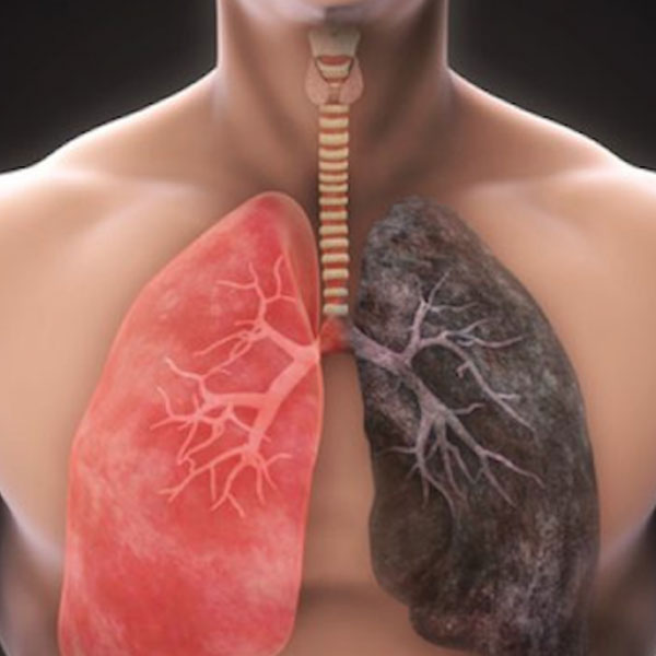 Lung-Disorders